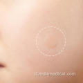 Patch di acne idrocolli